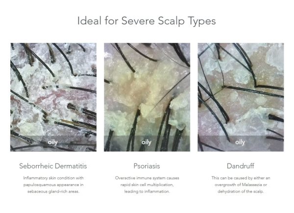 Dầu gội giảm gàu và viêm da đầu AROMASE MediPRO 5α Juniper Simply Fresh Shampoo 80ml